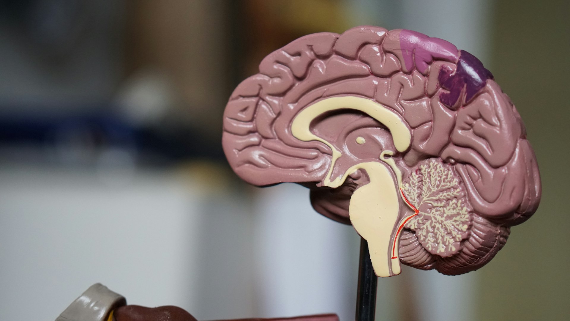 concussion model